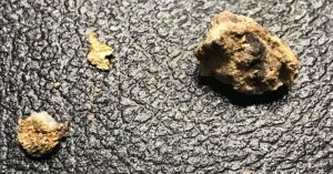 Metal detecting image related to Whites Goldmaster Gmx Sport Gold Detector